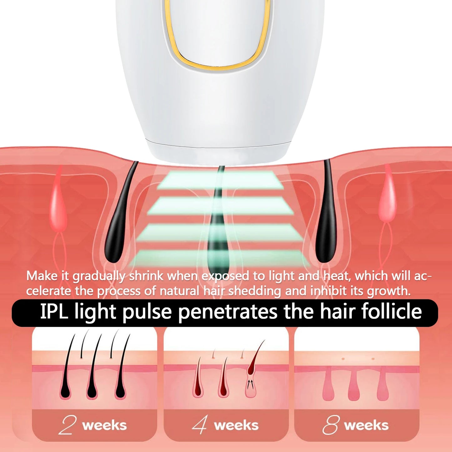 Épilateur laser professionnel à usage domestique pour homme et femme, combiné d'épilation IPL en continu